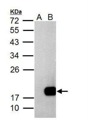 Western Blot: Deoxycytidylate deaminase Antibody [NBP2-16149]