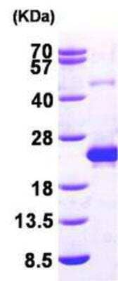 Western Blot: Recombinant Human Deoxycytidylate deaminase His Protein [NBP1-45280]