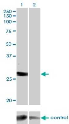 Western Blot: Deoxyguanosine kinase Antibody (3E9) [H00001716-M02]
