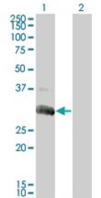 Western Blot: Deoxyguanosine kinase Antibody (3E9) [H00001716-M02]