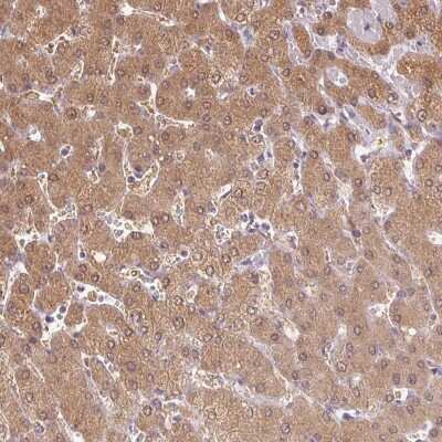 Immunohistochemistry: Deoxyguanosine kinase Antibody [NBP2-49251]