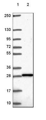 Western Blot: Deoxyguanosine kinase Antibody [NBP2-49251]