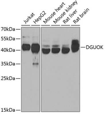 Western Blot: Deoxyguanosine kinase AntibodyBSA Free [NBP2-92801]