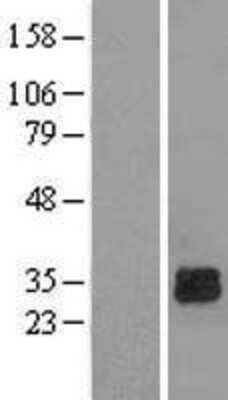 Western Blot: Deoxyguanosine kinase Overexpression Lysate [NBL1-09856]