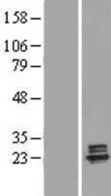 Western Blot: Deoxyguanosine kinase Overexpression Lysate [NBP2-05751]