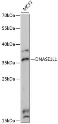 Western Blot: Deoxyribonuclease I like 1 AntibodyAzide and BSA Free [NBP2-92646]