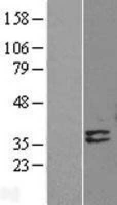 Western Blot: Deoxyribonuclease I like 1 Overexpression Lysate [NBL1-09960]