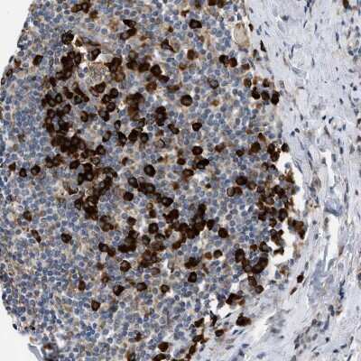 Immunohistochemistry-Paraffin: Derlin 1 Antibody [NBP1-88023]