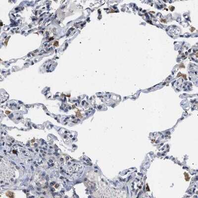 Immunohistochemistry-Paraffin: Derlin 1 Antibody [NBP1-88023]