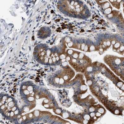 Immunohistochemistry-Paraffin: Derlin 1 Antibody [NBP1-88023]