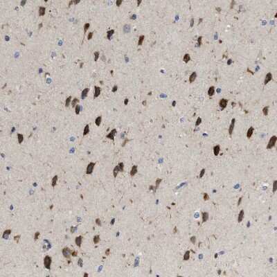 Immunohistochemistry-Paraffin: Derlin 1 Antibody [NBP1-88023]