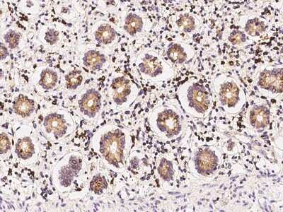 Immunohistochemistry-Paraffin: Derlin 1 Antibody [NBP2-97369]