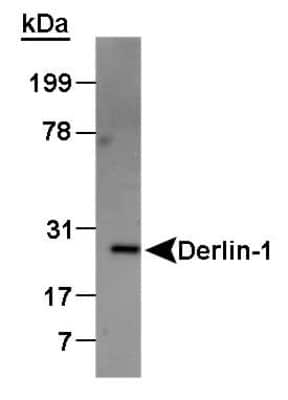 Western Blot: Derlin 1 Antibody [NB100-448]