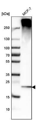 Western Blot: Derlin 1 Antibody [NBP1-88023]