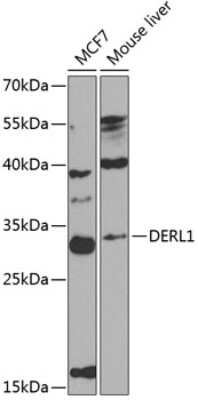 Western Blot: Derlin 1 AntibodyBSA Free [NBP2-92553]