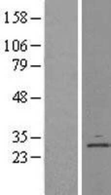 Western Blot: Derlin 1 Overexpression Lysate [NBL1-09837]