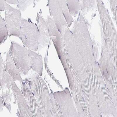 Immunohistochemistry-Paraffin: Derlin-2 Antibody [NBP2-47485]