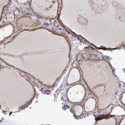 Immunohistochemistry-Paraffin: Derlin-2 Antibody [NBP2-47485]