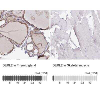 Immunohistochemistry-Paraffin: Derlin-2 Antibody [NBP2-47485]