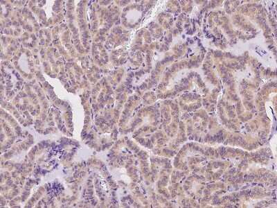 Immunohistochemistry-Paraffin: Derlin-2 Antibody [NBP2-98598]