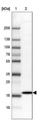 Western Blot: Derlin-2 Antibody [NBP2-47485]