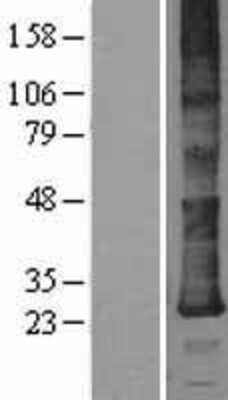 Western Blot: Derlin-2 Overexpression Lysate [NBL1-09838]