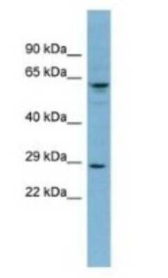 Western Blot: Derlin-3 Antibody [NBP1-59466]