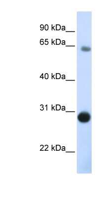 Western Blot: Derlin-3 Antibody [NBP1-59467]