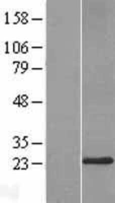 Western Blot: Derlin-3 Overexpression Lysate [NBP2-10736]