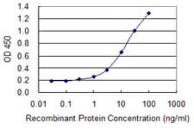 ELISA: Dermatopontin Antibody (2A11) [H00001805-M08]