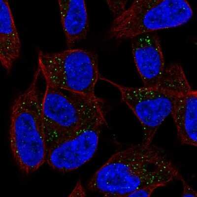 Immunocytochemistry/ Immunofluorescence: Dermatopontin Antibody [NBP2-56549]