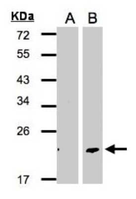 Western Blot: Dermatopontin Antibody [NBP2-14930]