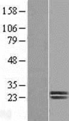 Western Blot: Dermatopontin Overexpression Lysate [NBL1-10005]