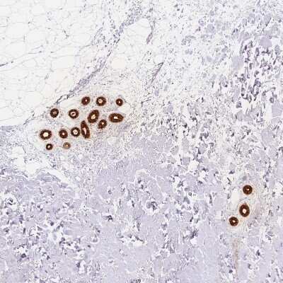 Immunohistochemistry-Paraffin: Dermcidin Antibody [NBP2-56558]