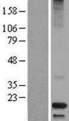 Western Blot: Dermcidin Overexpression Lysate [NBL1-09738]