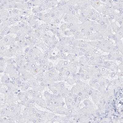 Immunohistochemistry-Paraffin: Dermokine beta Antibody [NBP1-86840]