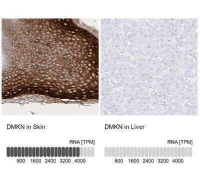 Immunohistochemistry-Paraffin: Dermokine beta Antibody [NBP1-86840]