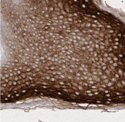 Immunohistochemistry-Paraffin: Dermokine beta Antibody [NBP1-86840]