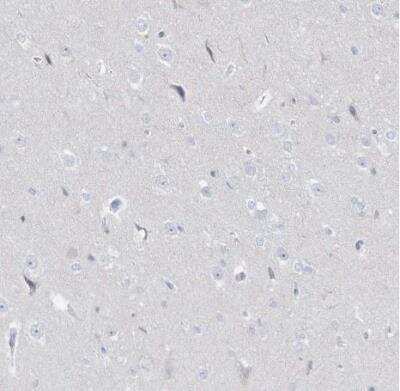 Immunohistochemistry-Paraffin: Dermokine beta Antibody [NBP1-86840]