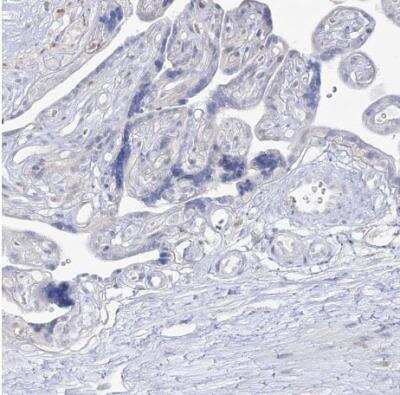 Immunohistochemistry-Paraffin: Dermokine beta Antibody [NBP1-86840]