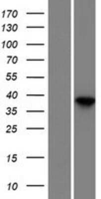 Western Blot: Dermokine beta Overexpression Lysate [NBP2-11393]