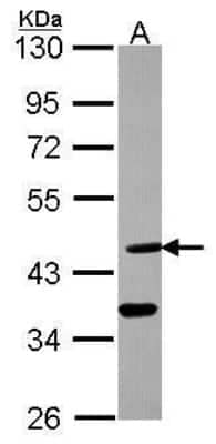 Western Blot: Desert Hedgehog/Dhh Antibody [NBP2-42834]