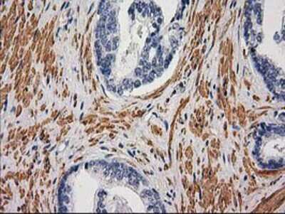Immunohistochemistry-Paraffin: Desmin Antibody (OTI4G1) [NBP2-03539]