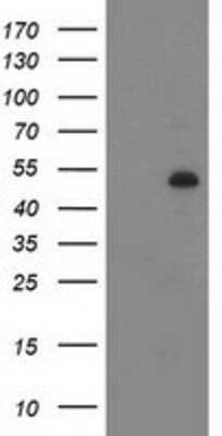 Western Blot: Desmin Antibody (OTI4G1) [NBP2-03539]