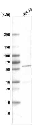 Western Blot: Desmin Antibody (CL4501) [NBP2-59055]