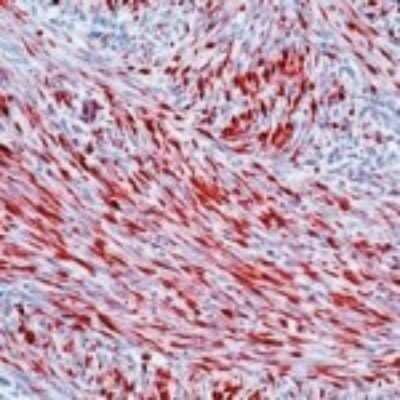 Immunohistochemistry-Paraffin: Desmin Antibody (D33) [NB120-17156]