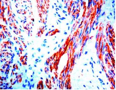 Immunohistochemistry-Paraffin: Desmin Antibody (D33) [NB120-17156]