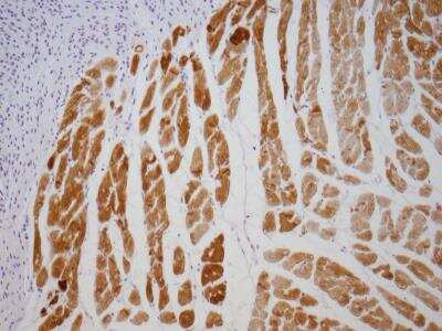 Immunohistochemistry-Paraffin: Desmin Antibody (D33) [NB120-17156]