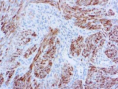 Immunohistochemistry-Paraffin: Desmin Antibody (D33) [NB120-17156]