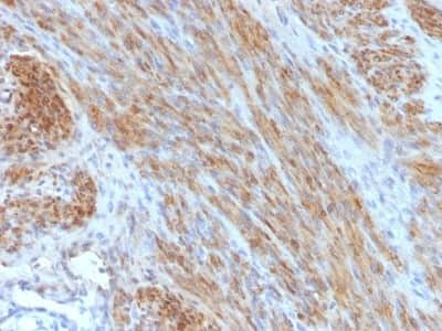 Immunohistochemistry-Paraffin: Desmin Antibody (DES/1711) - Azide and BSA Free [NBP2-54503]